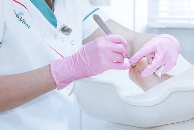 Afbeelding medische pedicure behandeling